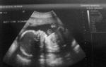 Фото плода, фото живота, узи и видео о развитии ребенка В утробе матери 25 недель